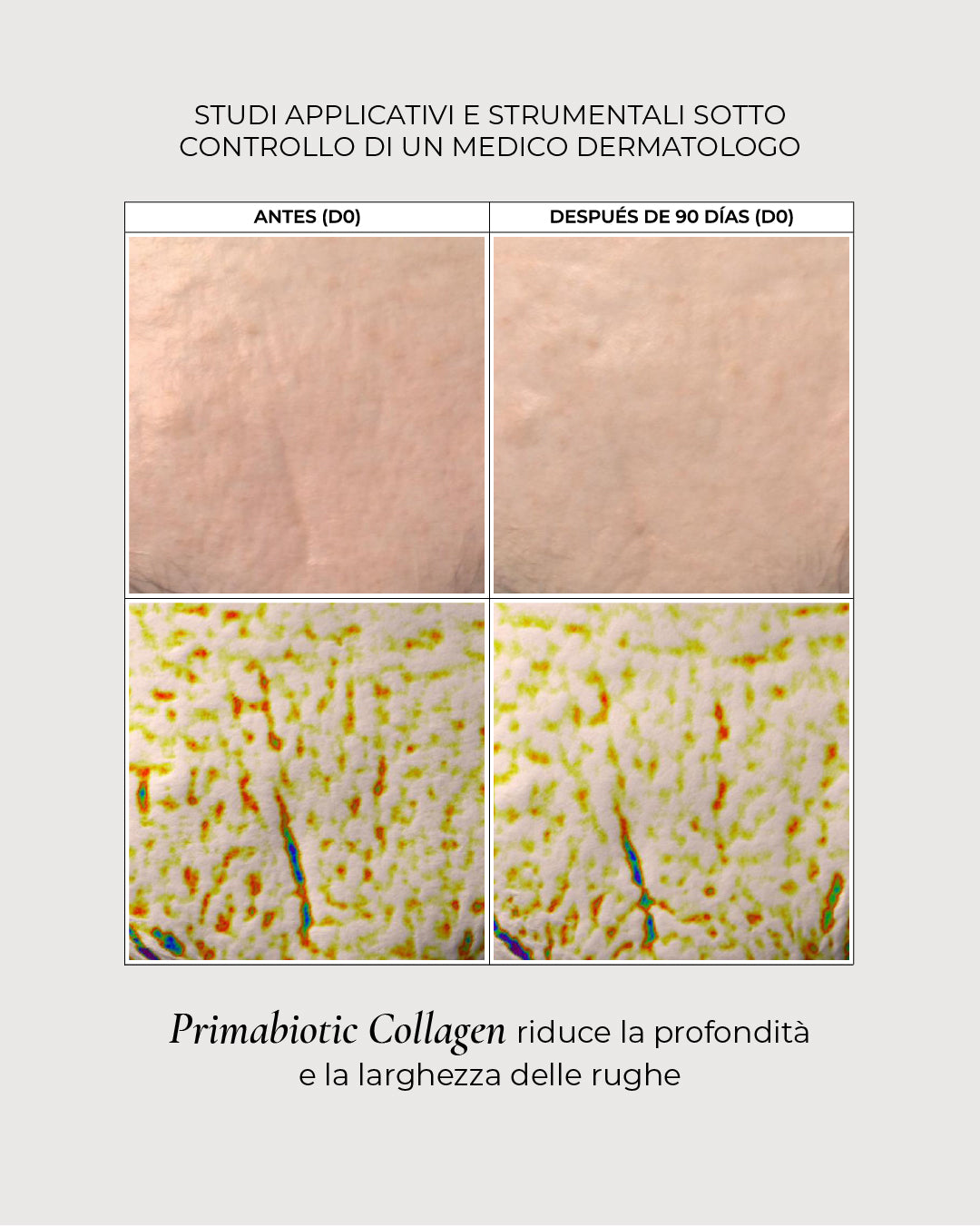 confronto prima e dopo 90 giorni con Primabiotic Collagen che riduce la profondità e la larghezza delle rughe sotto controllo dermatologico